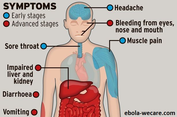 Diagram of ebola symptoms